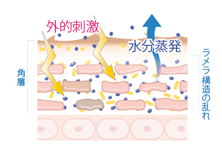 角層は外的刺激を受けたり、水分蒸発すると、ラメラ構造が乱れます。