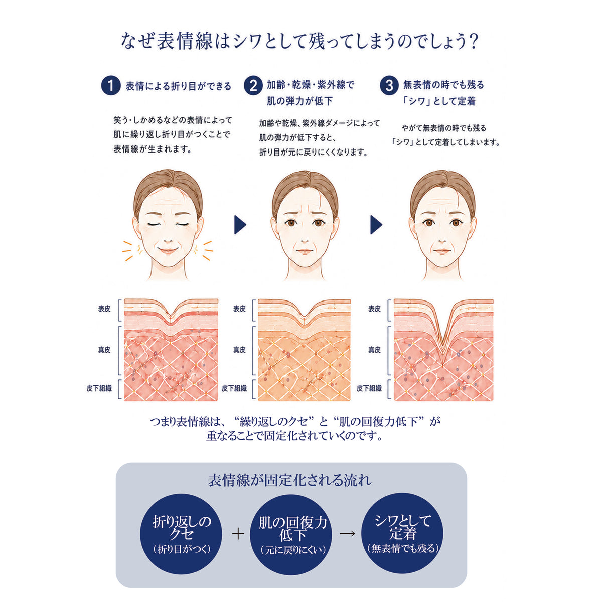 なぜ表情線はシワとして残ってしまうのでしょうか？

1 表情による折り目ができる
笑う・しかめるなどの表情によって肌に繰り返し折り目がつくことで表情線が生まれます。

2 加齢・乾燥・紫外線で肌の弾力が低下
加齢や乾燥、紫外線ダメージによって肌の弾力が低下すると、折り目が元に戻りにくくなります。

3 無表情の時でも残る「シワ」として定着
やがて無表情の時でも残る「シワ」として定着してしまいます。

つまり表情線は、“繰り返しのクセ”と“肌の回復力低下”が重なることで固定化されていくのです。

表情線が固定化される流れ
[折り目のクセ（折り目がつく）] ＋ [肌の回復力低下（元に戻りにくい）] → [シワとして定着（無表情でも残る）]