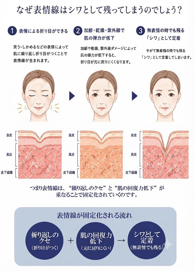 ステップ1（同じ折り目を繰り返さない）： 眉間に力を入れるクセやスマホを見る時のクセを意識し、表情筋をゆるめリラックスする大切さを解説。

ステップ2（保湿で肌の柔軟性を保つ）： 乾燥による柔軟性低下を防ぎ、たっぷりの保湿でやわらかい肌をキープする説明。

ステップ3（紫外線対策を毎日欠かさない）： 日焼け止め、帽子、サングラスを活用し、365日紫外線から肌を守る対策。

ステップ4（肌の回復力をサポートする習慣）： エイジング対応スキンケア、質の良い睡眠、バランスの良い食事の3つの要素。

まとめ： 「健やかな肌を育てる毎日の習慣が、表情線を寄せつけない土台になります。」というメッセージ。