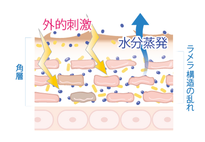 角層は外的刺激を受けたり、水分蒸発すると、ラメラ構造が乱れます。